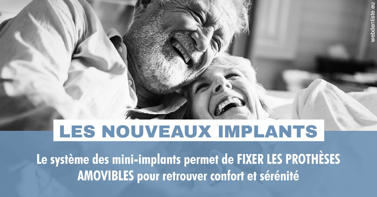 https://dr-charles-amelie.chirurgiens-dentistes.fr/Les nouveaux implants 2
