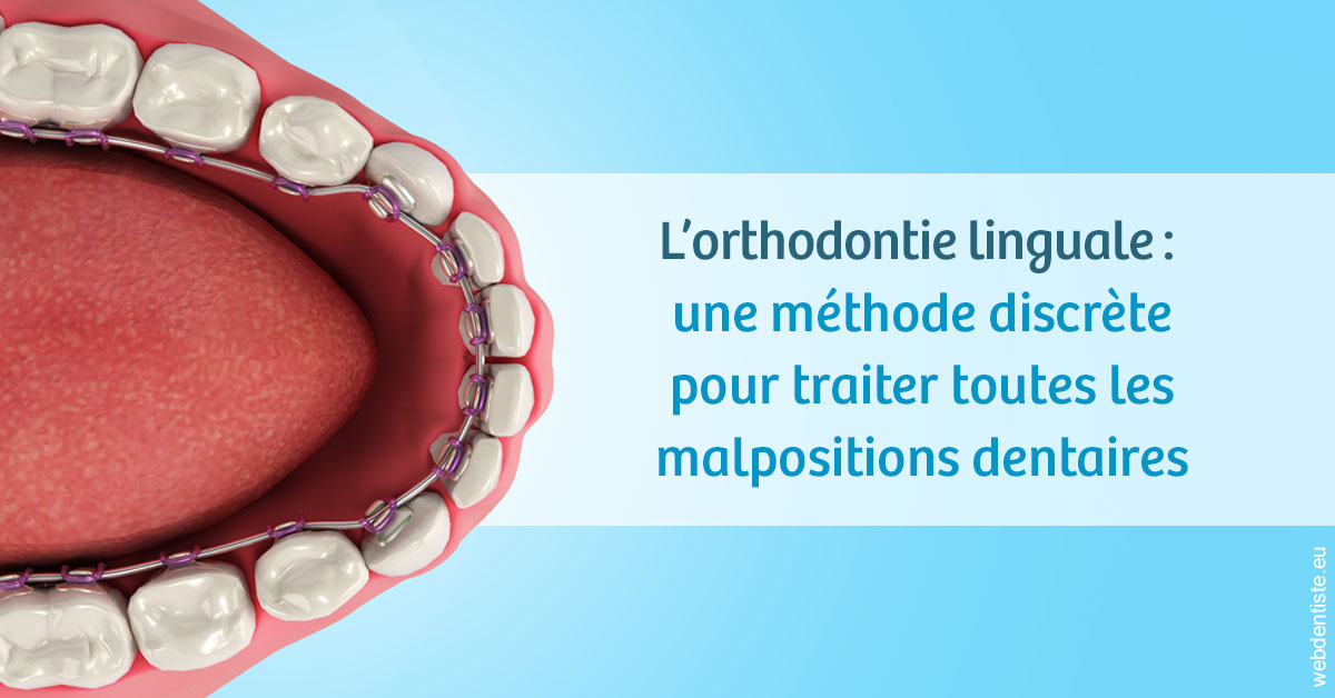 https://dr-charles-amelie.chirurgiens-dentistes.fr/L'orthodontie linguale 1