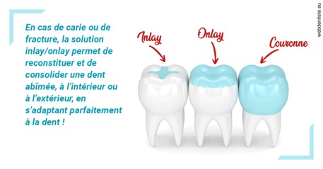 https://dr-charles-amelie.chirurgiens-dentistes.fr/L'INLAY ou l'ONLAY