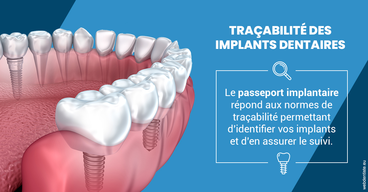 https://dr-charles-amelie.chirurgiens-dentistes.fr/T2 2023 - Traçabilité des implants 1