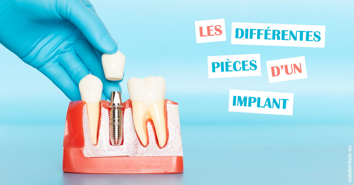 https://dr-charles-amelie.chirurgiens-dentistes.fr/Les différentes pièces d’un implant 2