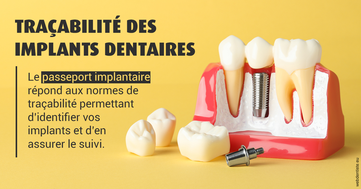 https://dr-charles-amelie.chirurgiens-dentistes.fr/T2 2023 - Traçabilité des implants 2