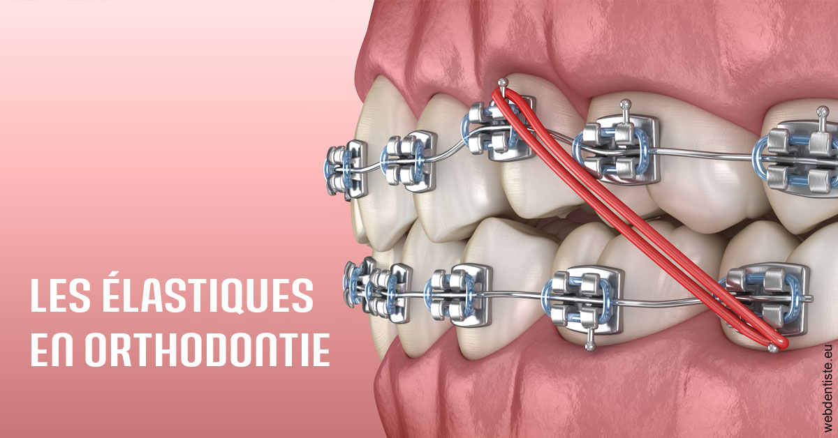 https://dr-charles-amelie.chirurgiens-dentistes.fr/Elastiques orthodontie 2